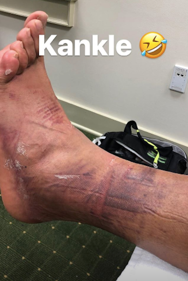 Illustration for article titled Tony Finau Played The Entire Masters On This Gross, Fucked-Up Ankle